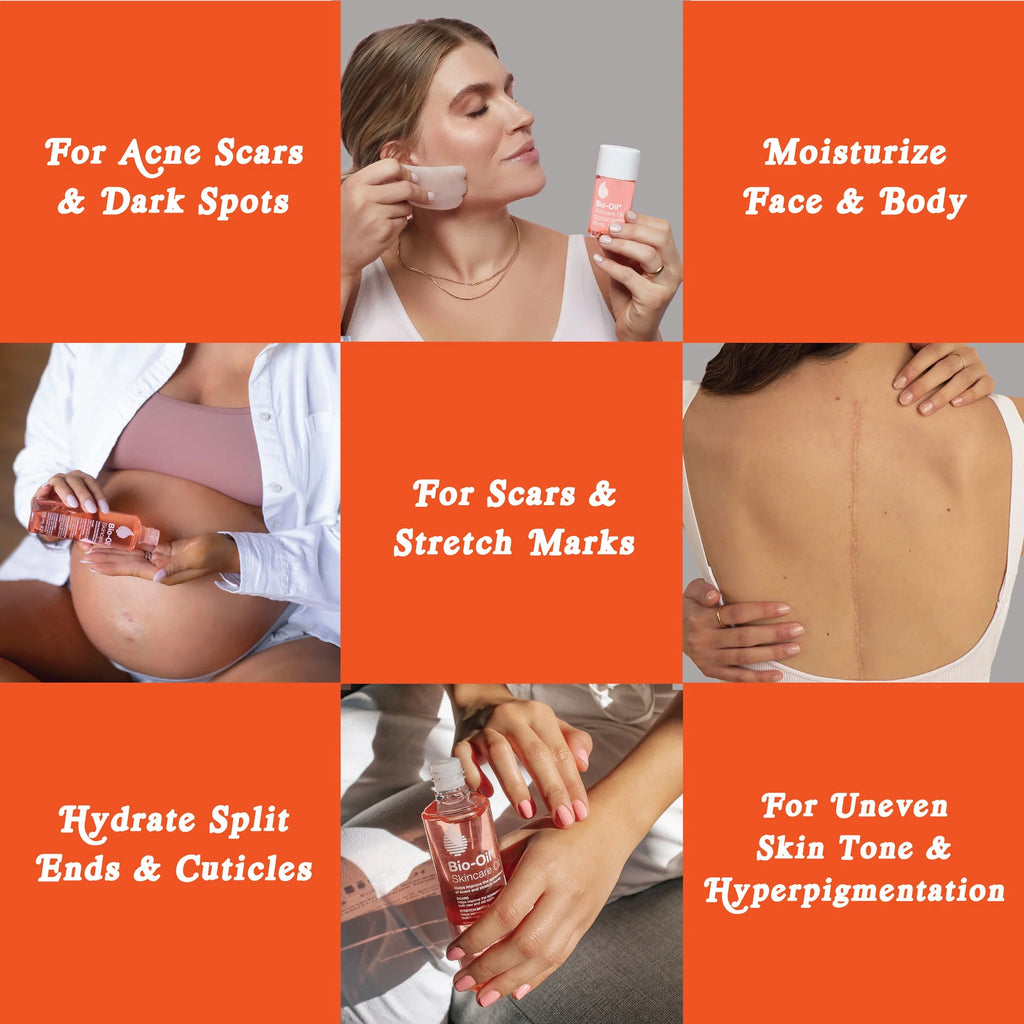 Body Oil for Scars & Stretch Marks 4.2 fl oz V23661